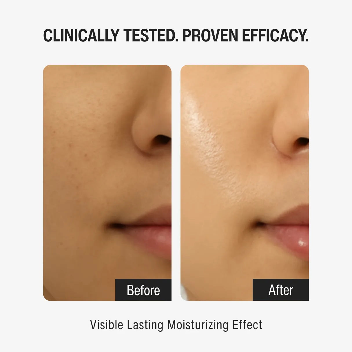 1% RETINOL DAY MOISTURIZER SPF 15 | YOUTH RENEWAL STEP 04