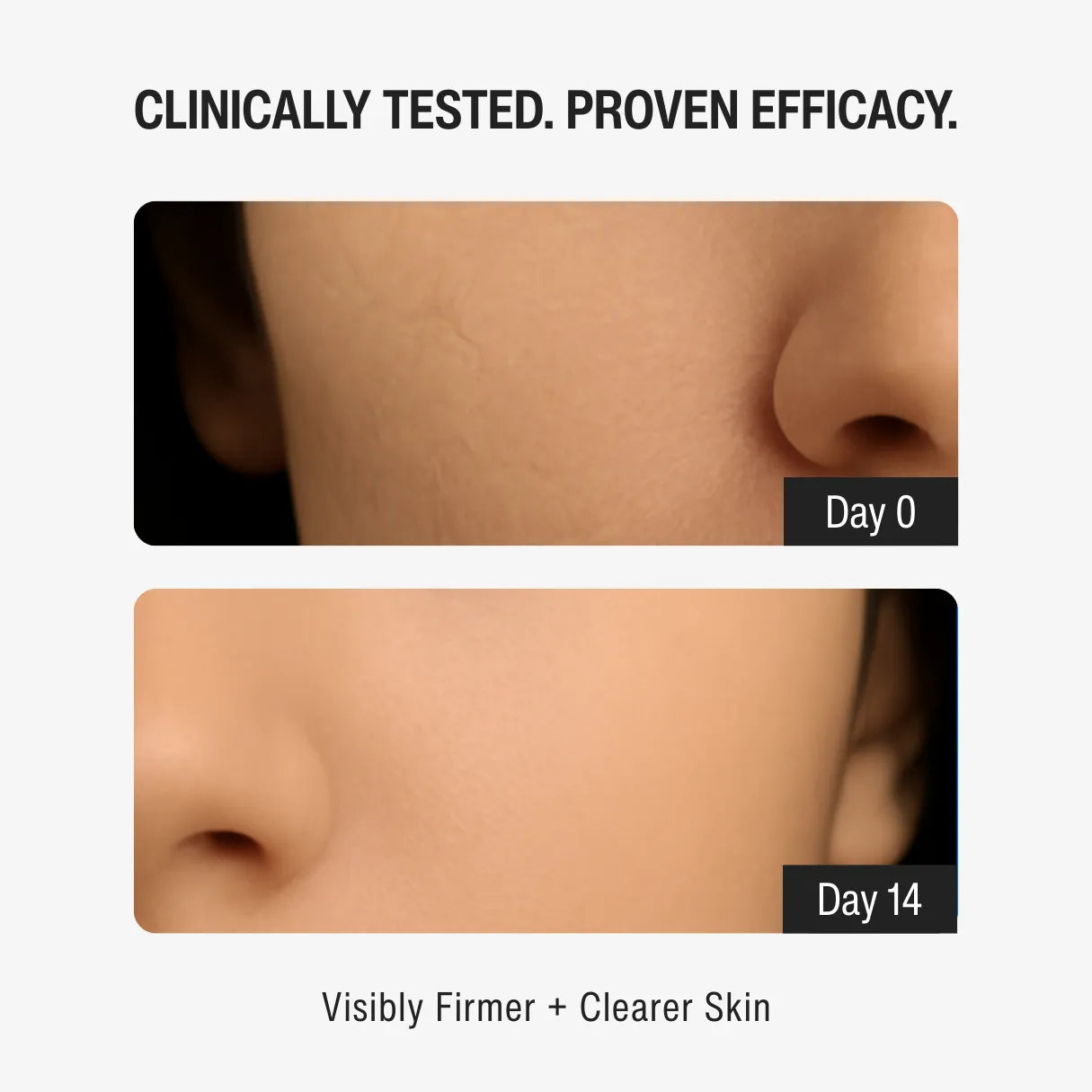 1% RETINOL DAY MOISTURIZER SPF 15 | YOUTH RENEWAL STEP 04