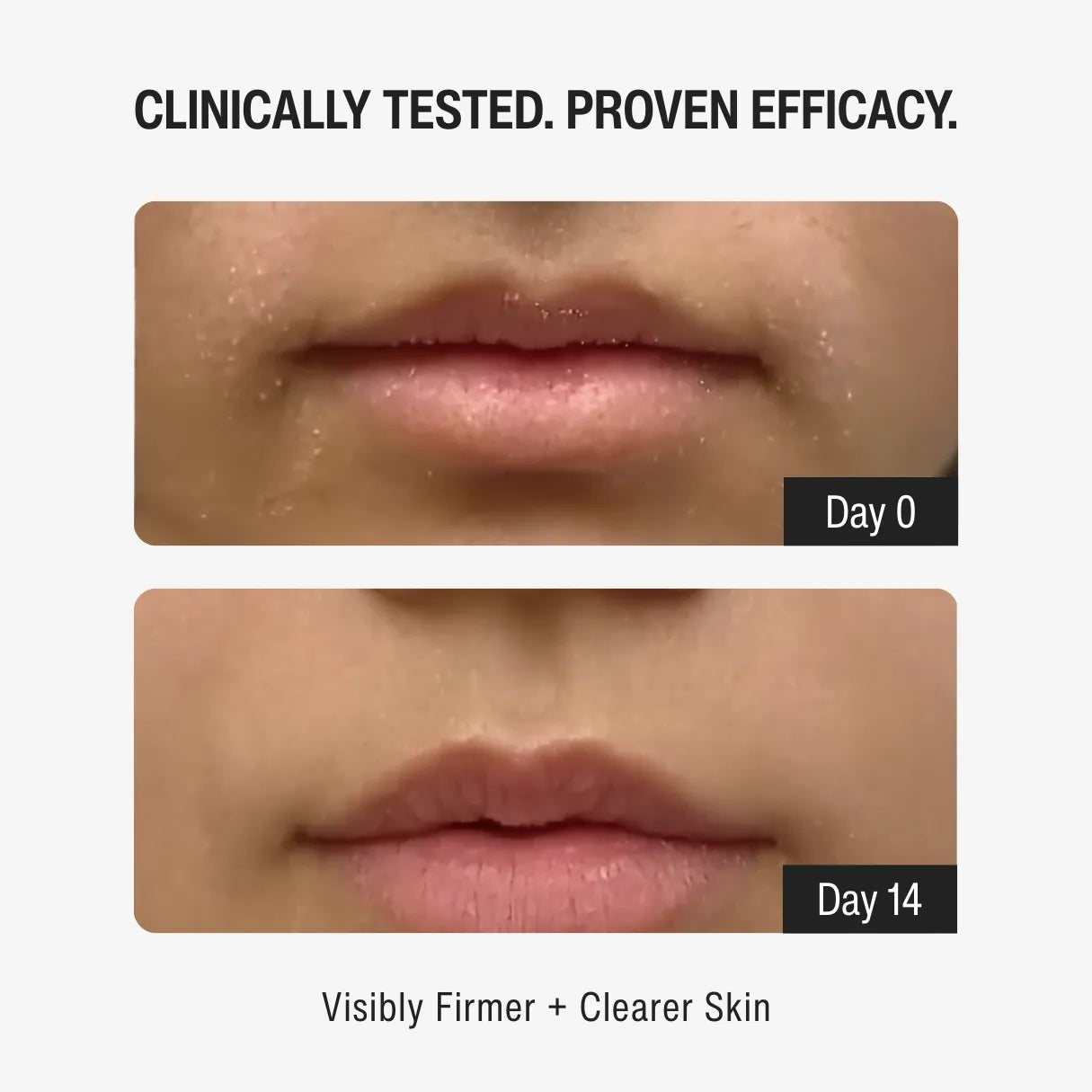 1% RETINOL DAY MOISTURIZER SPF 15 | YOUTH RENEWAL STEP 04