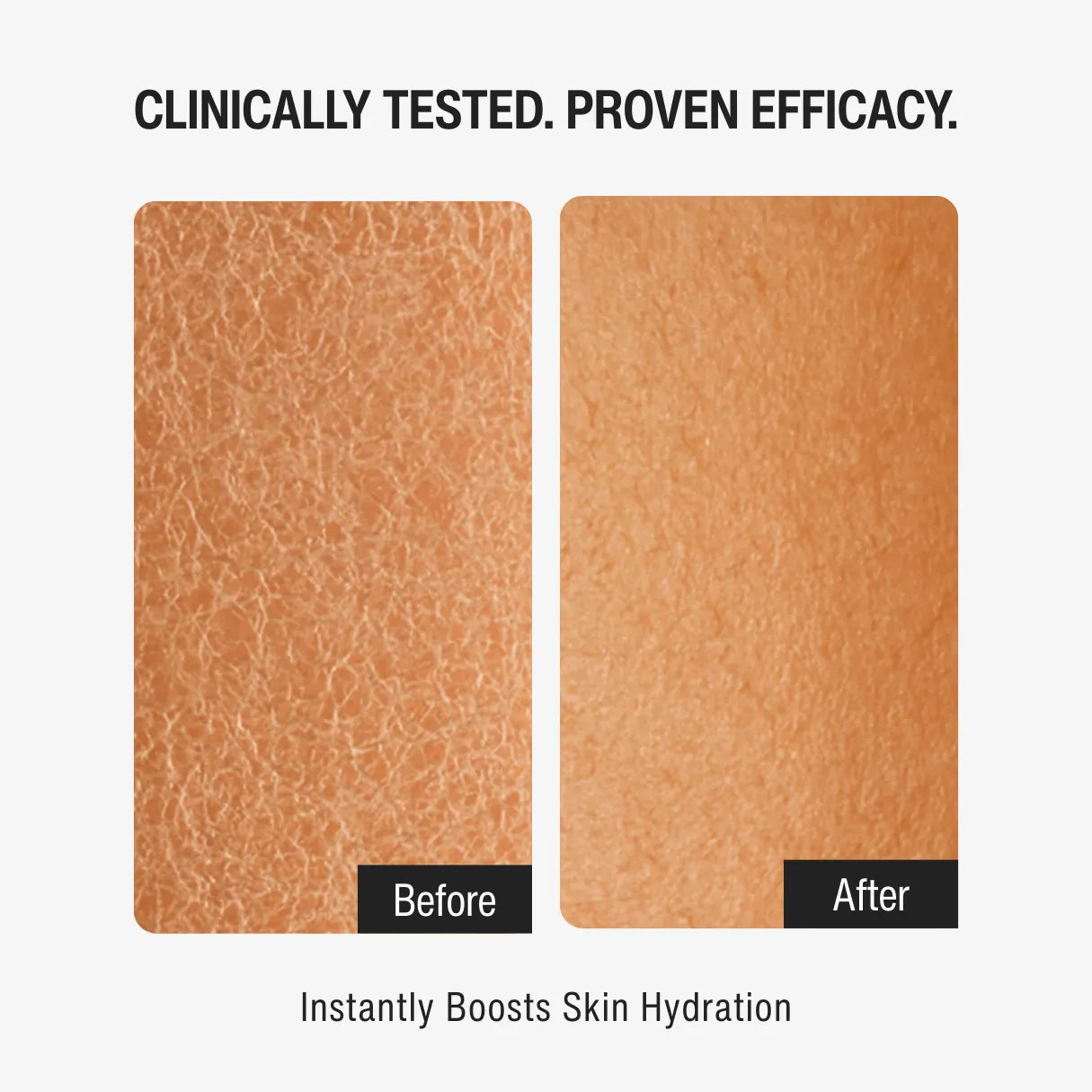 1% RETINOL NIGHT MOISTURIZER | YOUTH RENEWAL STEP 05