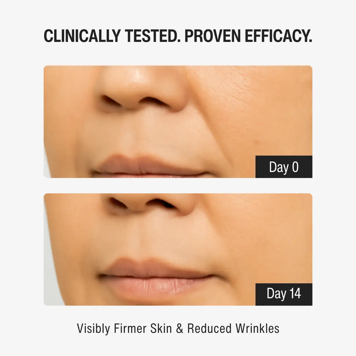 1% RETINOL SERUM | YOUTH RENEWAL STEP 03
