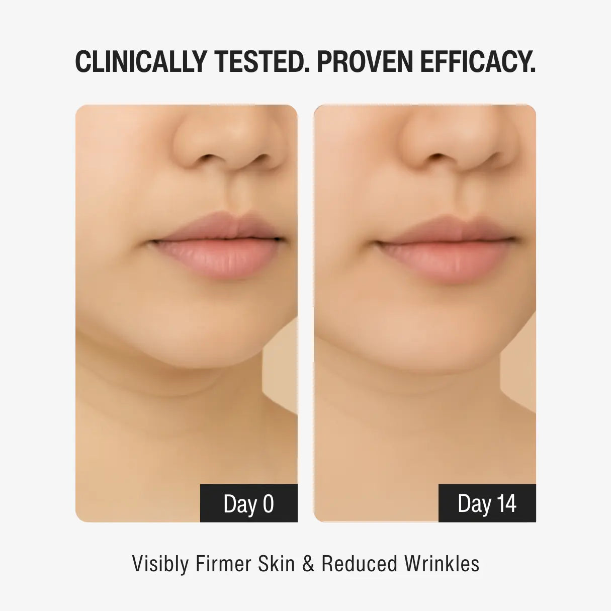 1% RETINOL SERUM | YOUTH RENEWAL STEP 03