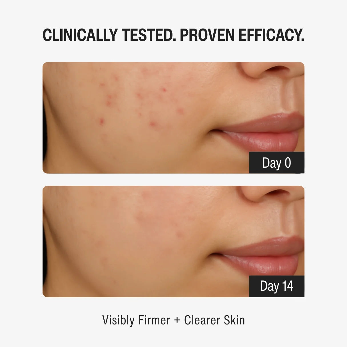 1% RETINOL CLEANSER | YOUTH RENEWAL STEP 01